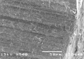 Hình 3 7 Hình ảnh mặt cắt răng bình thường ở độ phóng đại 500 – 750 1000 13