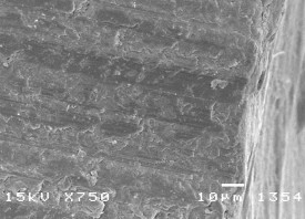 Hình 3 7 Hình ảnh mặt cắt răng bình thường ở độ phóng đại 500 – 750 1000 14