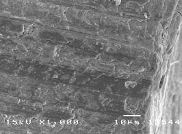 Hình 3 7 Hình ảnh mặt cắt răng bình thường ở độ phóng đại 500 – 750 1000 15