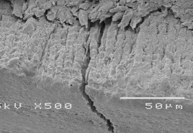 Hình 3 8 Hình ảnh mặt cắt răng tương ứng sâu răng D 1 ở độ phóng đại 500 16