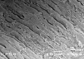 Hình 3 8 Hình ảnh mặt cắt răng tương ứng sâu răng D 1 ở độ phóng đại 500 17