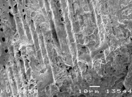 Hình 3 9 Hình ảnh mặt cắt răng tương ứng sâu răng D 2 ở độ phóng đại 750 18