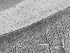 Hình 3 12 Hình ảnh tái khoáng của tổn thương sâu răng D 2 sau điều trị bằng 22