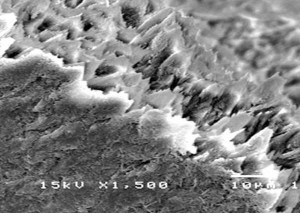 Hình 3 15 Hình ảnh cắt ngang các trụ men có tổn thương sâu răng D 2 sau điều 27