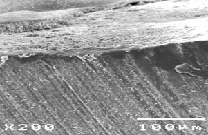 Hình 3 16 Hình ảnh sâu răng D 1 sau điều trị bằng Clinpro TM XT varnish ở độ 28