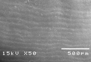 Hình 3 4 Bề mặt răng bình thường ở độ phóng đại 50 – 3500 lần Hình 3 5 7