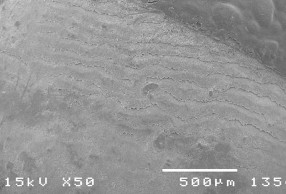 Hình 3 5 Bề mặt răng tương ứng sâu răng D 1 ở độ phóng đại 50 – 3500 lần 9