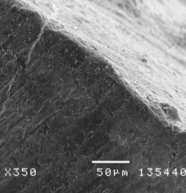 Hình 3 26 Hình ảnh bề mặt và mặt cắt ngang tổn thương sâu răng D 1 sau điều 12