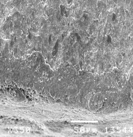 Hình 3 26 Hình ảnh bề mặt và mặt cắt ngang tổn thương sâu răng D 1 sau điều 13