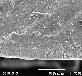 Hình 3 27 Hình ảnh mặt cắt ngang tổn thương sâu răng D 1 sau điều trị bằng 14