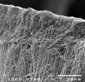 Hình 3 27 Hình ảnh mặt cắt ngang tổn thương sâu răng D 1 sau điều trị bằng 15