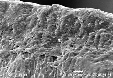 Hình 3 28 Hình ảnh mặt cắt ngang tổn thương sâu răng D 1 sau điều trị bằng 16