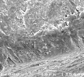 Hình 3 29 Hình ảnh bề mặt và mặt cắt ngang tổn thương sâu răng D 1 sau điều 17