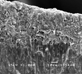 Hình 3 29 Hình ảnh bề mặt và mặt cắt ngang tổn thương sâu răng D 1 sau điều 18