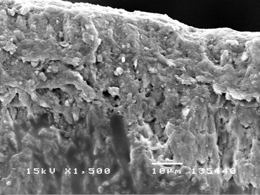 Hình 3 30 Hình ảnh mặt cắt ngang tổn thương sâu răng D 1 sau điều trị bằng 19