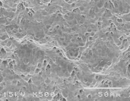 Hình 3 22 Hình ảnh bề mặt và mặt cắt ngang tổn thương sâu răng D 2 sau điều 6