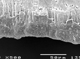 Hình 3 22 Hình ảnh bề mặt và mặt cắt ngang tổn thương sâu răng D 2 sau điều 7