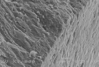 Hình 3 24 Hình ảnh bề mặt và mặt cắt ngang của sâu răng D 2 sau điều trị 9