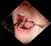 Hình 1 3 Thiết bị ECM a Máy ECM b Đầu đo của ECM 49 1 5 3 Phương pháp soi 3