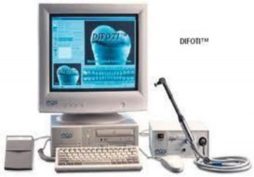 Hình 1 4 Hình ảnh máy DIFOTI 50 Hình 1 5 Hình ảnh FOTI trên răng a nhìn bằng 4