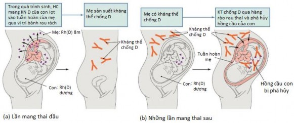 Hình 1 1 Cơ chế sinh kháng thể chống D ở sản phụ Rh D âm 32 1 2 3 Các yếu 1