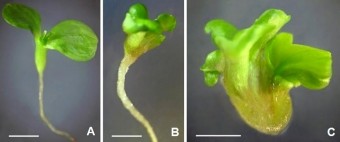 Hình 3 7 Phôi bình thường và một số dạng bất thường của phôi vô tính A 3