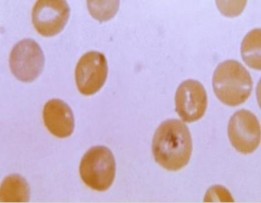 1 2 Môi trường lỏng I Ống số 1 là chứng âm và mẫu nghiên cứu ống số 2 7