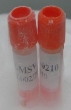 Hình 2 1 Hình ảnh ống chủng Beijing 1 và vắc xin JECEVAX Địa điểm nghiên cứu 1