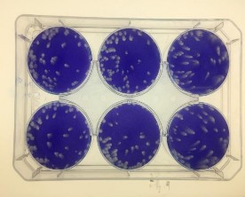 Thử nghiệm tạo đám hoại tử PFU trên tế bào BHK21 Thử nghiệm tạo đám 1