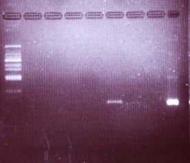 1 2 3 4 5 6 7 8 9 Ảnh 3 1 Mẫu không khí dương tính 1 2 3 4 5 6 7 8 9 Ảnh 3 2 Mẫu 1