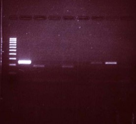 Ảnh 3 2 Mẫu quệt bề mặt dụng cụ dương tính 1 Marker 2 Chứng âm 3 – 8 2