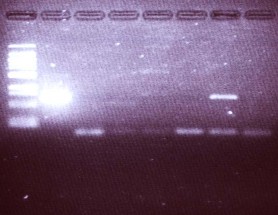 1 2 3 4 5 6 7 8 Ảnh 3 3 Mẫu quệt mũi dương tính 1 Marker 2 Chứng dương 8 Chứng 3