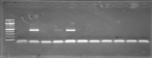 1 Marker 2 Chứng âm 3 Chứng dương 4 12 Mẫu Mẫu số 5 Khay để đờm Mẫu 6