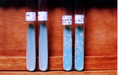 Ảnh 2 2 Nuôi cấy vi khuẩn lao trên môi trường Loeweinstein Jensen Nuôi cấy trên 2