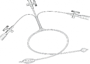 Hình 1 3 Mô hình cầu nối Pruitt–Inahara shunt mạch máu tạm thời ⃰ Nguồn 2