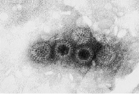 Hình 1 2 Ảnh chụp RV dưới kính hiển vi điện tử 42 1 1 2 Cấu trúc Dưới 1