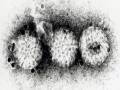 Hình Ảnh Hạt Virut Rota G1P [8] Dưới Kính Hiển Vi Điện Tử Tại Lần Cấy Truyền Thứ 30 Trên Tế Bào Thận Khỉ Tiên Phát Chụp Dưới Kính Hiển Vi