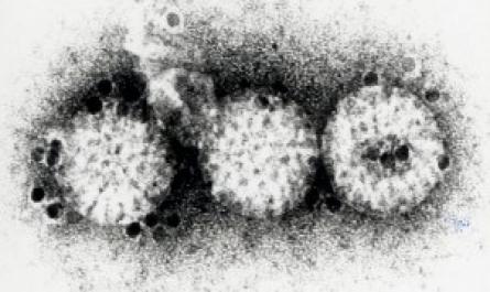 Hình Ảnh Hạt Virut Rota G1P [8] Dưới Kính Hiển Vi Điện Tử Tại Lần Cấy Truyền Thứ 30 Trên
