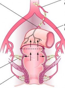 tràng dưới Động mạch chậu chung Hình 1 4 Dẫn lưu bạch huyết trên và giữa 1