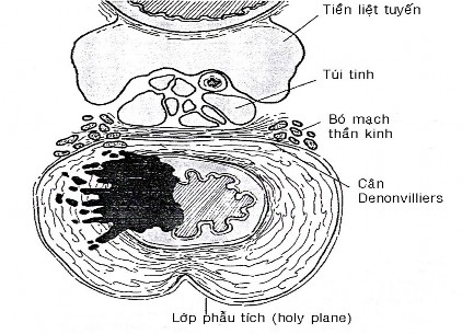 Hình 1 6 Mạc treo trực tràng thiết đồ cắt ngang 94 Hình 1 7 Thiết đồ cắt 3