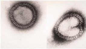 8 phân đoạn mã hoá cho 11 protein Về mặt cấu trúc nucleocapsid được bao bọc 2