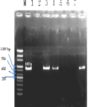 b Hình 3 2 Kết quả PCR xác định sự có mặt của gen CTX M 9 a và TEM b M Mẫu 2