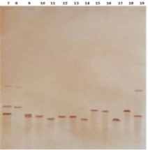 a b Hình 3 4 a và 3 4 b 3 4 a Sản phẩm PCR đã được enzym giới hạn S1 phát 6
