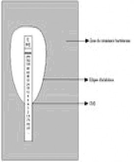 Hình 1 6 Cách xác định kết quả MIC bằng Etest 108 Vùng vi khuẩn phát triển 1