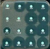 Hình 2 1 Kháng sinh đồ trên hộp lồng vuông cạnh 120mm 2 5 3 4 Kỹ thuật khoanh 2