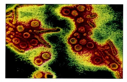 Hình 1 2 Vi rút viêm gan B dưới kính hiển vi điện tử 84 Các cấu trúc hình 1