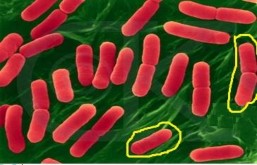  Bài toán 1 8 Tạm gọi là bài toán VI KHUẨN E COLI Sách bài tập Sinh học 10 12