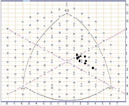 Biểu đồ 3 1 Thực trạng đặc điểm cấu trúc hình thể somatotype theo phương 1
