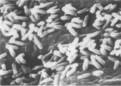 Hình 1 9 Vi khuẩn A tumefaciens bám trên bề mặt tế bào thực vật 71 Hình 1 10 9