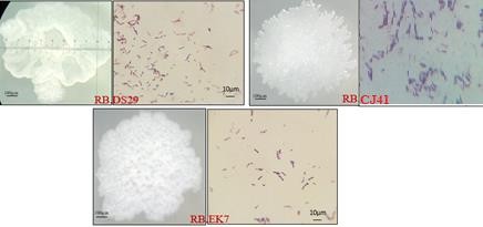 Hình 3 10 Hình dạng khuẩn lạc và tế bào của 3 chủng RB DS29 RB CJ41 và RB EK7 1